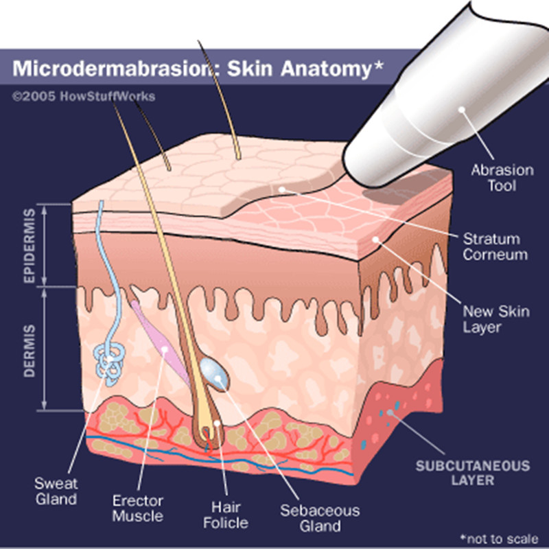 뜨거운 판매 Microdermabrasion 다이아몬드 박피 아름다움 기계 공장 직접 판매