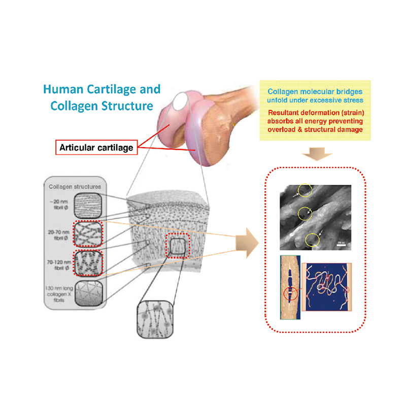 왜 중국 신발 재료 시장에서 ACFoam이 인기가 있습니까?