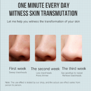 전기 추출기 여드름 제거 블랙 헤드 리무버 진공 아름다움 기계 기공 클리너